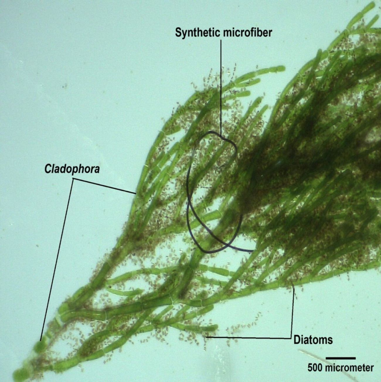 Microfibers under a microscope.